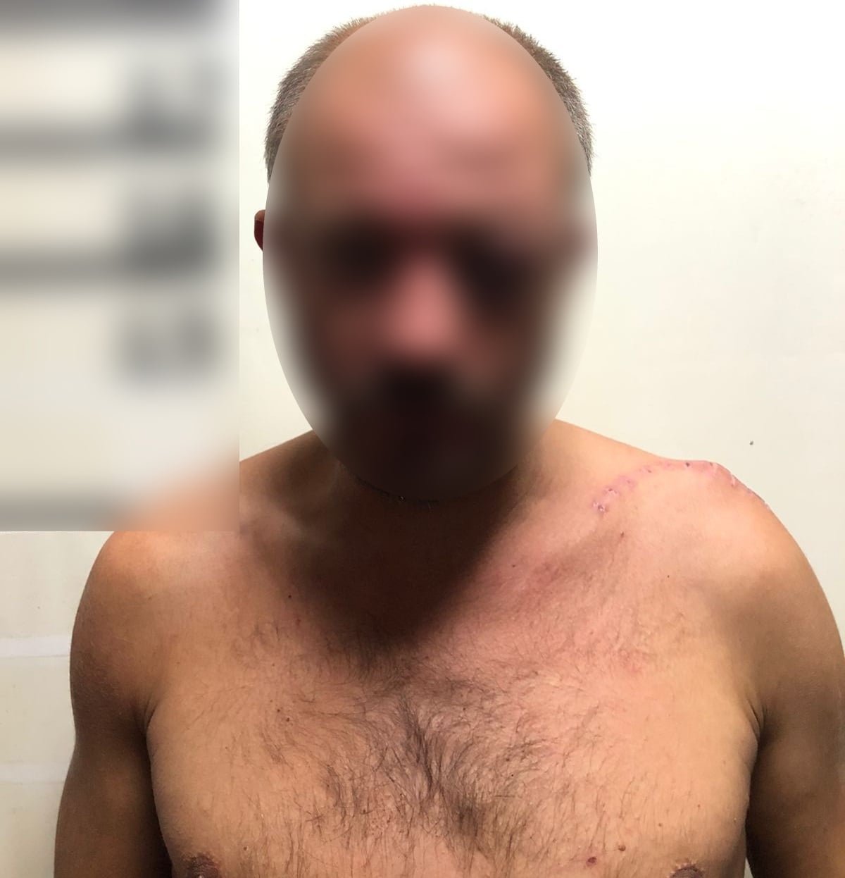 В Киевской области мужчина пришел к бывшей и напал с ножом на ее нового любовника 3