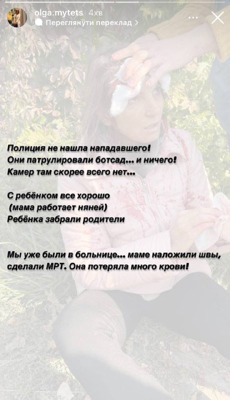 Выбежал из кустов и три раза ударил битой по голове: в ботсаду Киева неизвестный напал на женщину с коляской 2