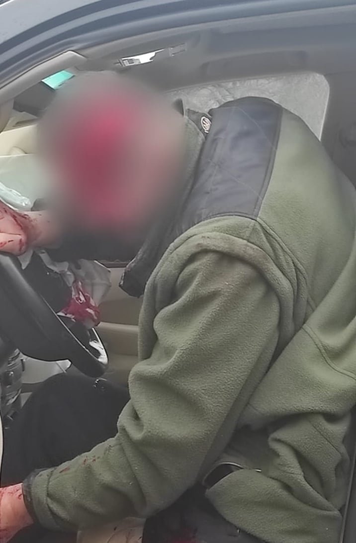Под Киевом Lexus влетел в дом и протаранил два забора: водителя увезла скорая 1