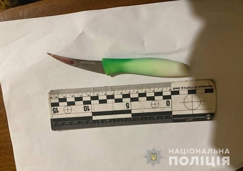 В Киеве пьяная женщина ударила ножом своего 4-летнего сына 3