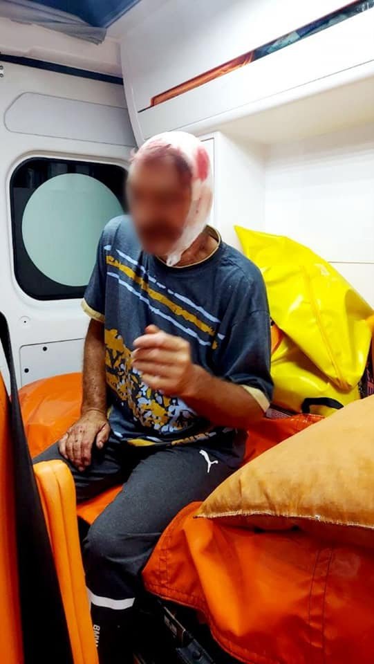 На Київщині чоловік прийшов до сусіда з сокирою та двічі вдарив його по голові 3