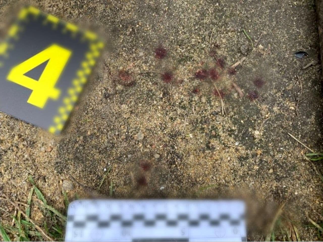 На Київщині чоловік за зауваження палицею розбив сусіду голову 3