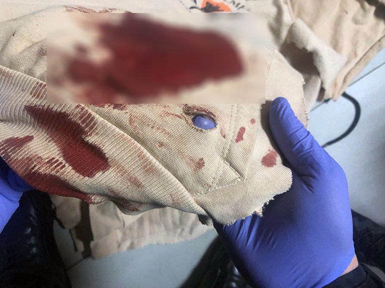 У Києві посеред вулиці чоловік вдарив неповнолітнього хлопця ножем у живіт 1