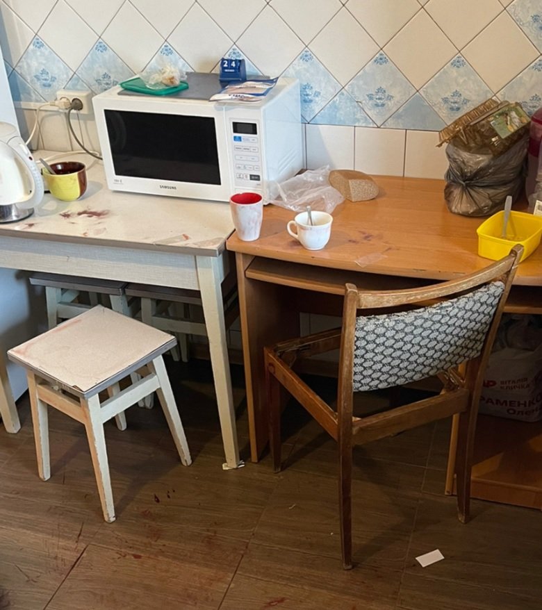 У Києві жінка вбила свого чоловіка ударом ножа у ногу 3