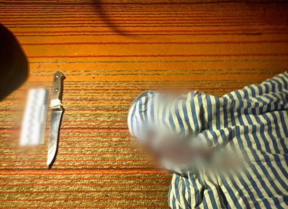 На Київщині чоловік ударив брата ножем у живіт та втік з дому 2