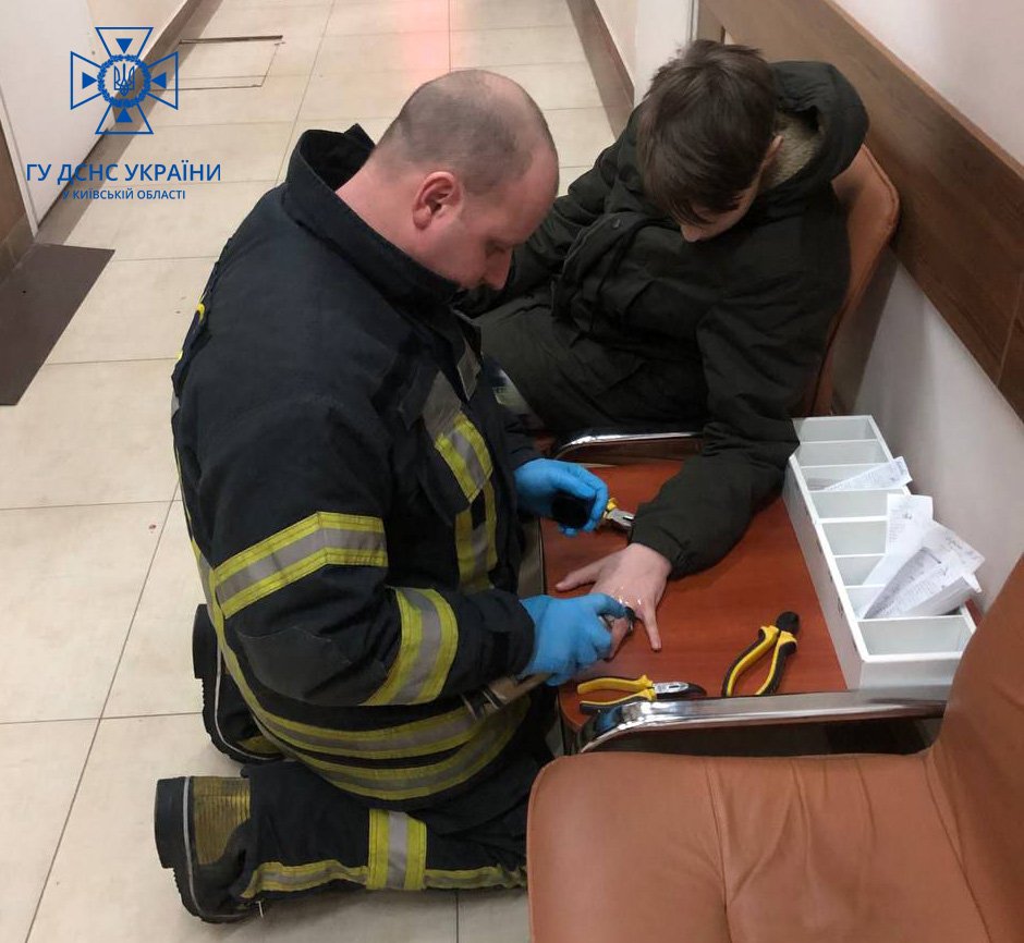 На Київщині у дитини на пальці застрягло металеве кільце від ліхтарика 1