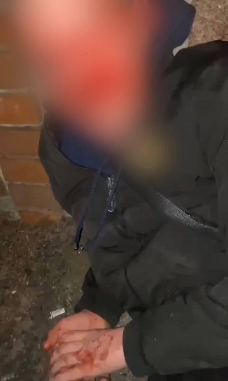 На Київщині підлітки жорстоко забили хлопця до втрати свідомості та зняли це на відео 4