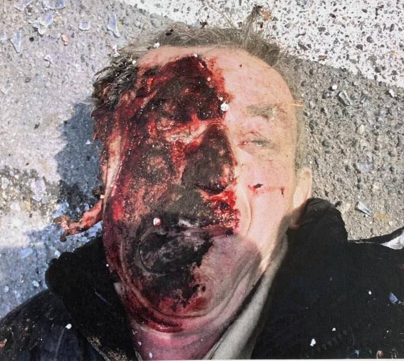 Поліція Київщини просить допомогти встановити особу загиблого в Ірпені чоловіка: фото 18+ 1