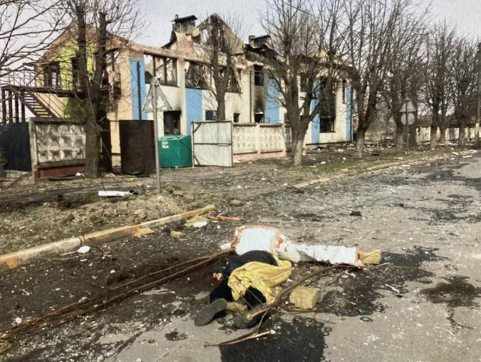 Поліція Київщини просить допомогти встановити особу загиблого в Ірпені чоловіка: фото 18+ 3