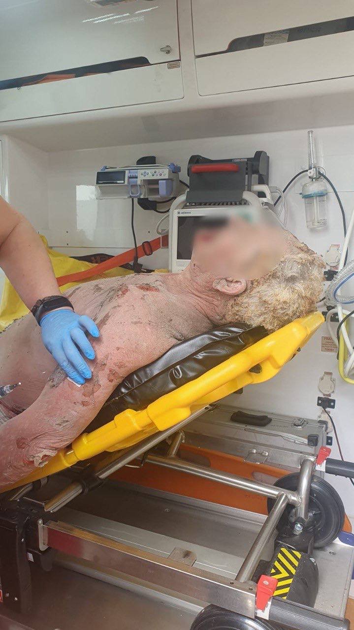 На Київщині у приватному будинку стався вибух: постраждав власник 1