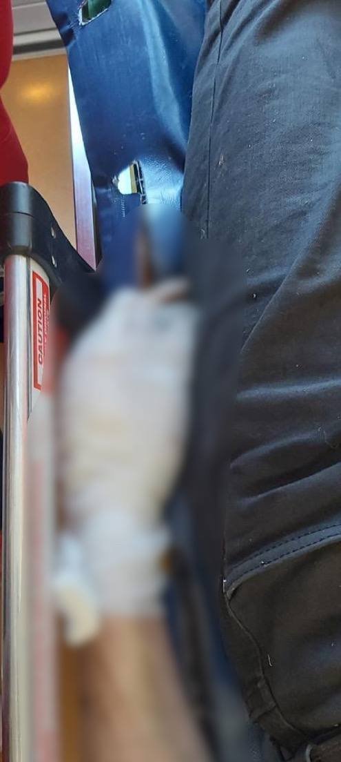 На Київщині у чоловіка вибухнув в руках запал від гранати 1