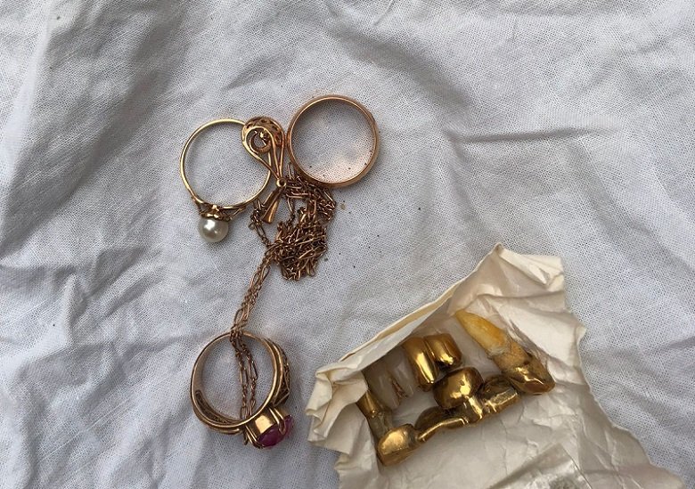 У Києві в пенсіонерки вкрали золоті зуби, прикраси та 200 000 гривень 2