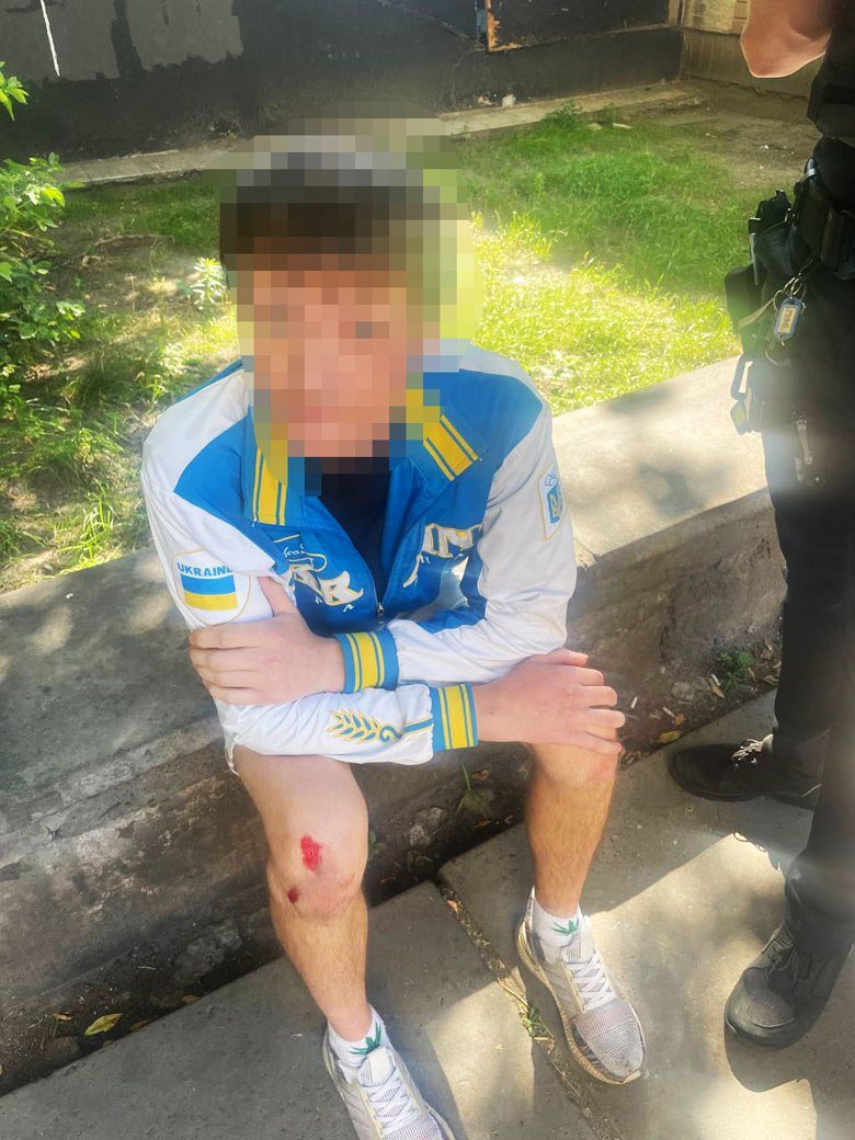 У Києві на Харківському масиві у дворі підпалили автомобіль 6