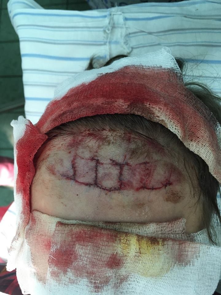 По словам матери ребенка, ему наложили 34 шва По словам матери ребенка, ему наложили 34 шва