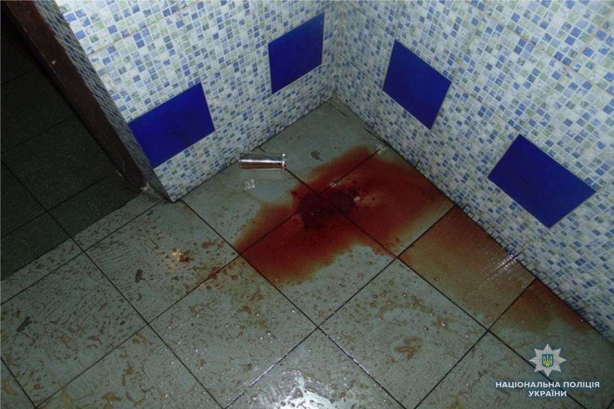 Мужчина лежал в луже крови