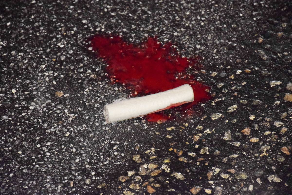 К счастью, пострадавшие живы К счастью, пострадавшие живы