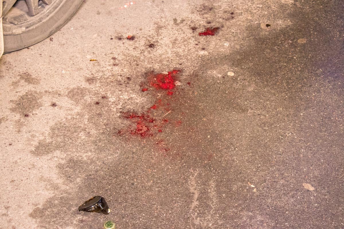 Пострадавший упал на штырь Пострадавший упал на штырь