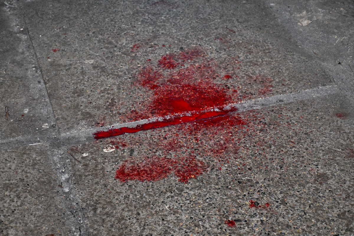 Пострадали двое мужчин Пострадали двое мужчин