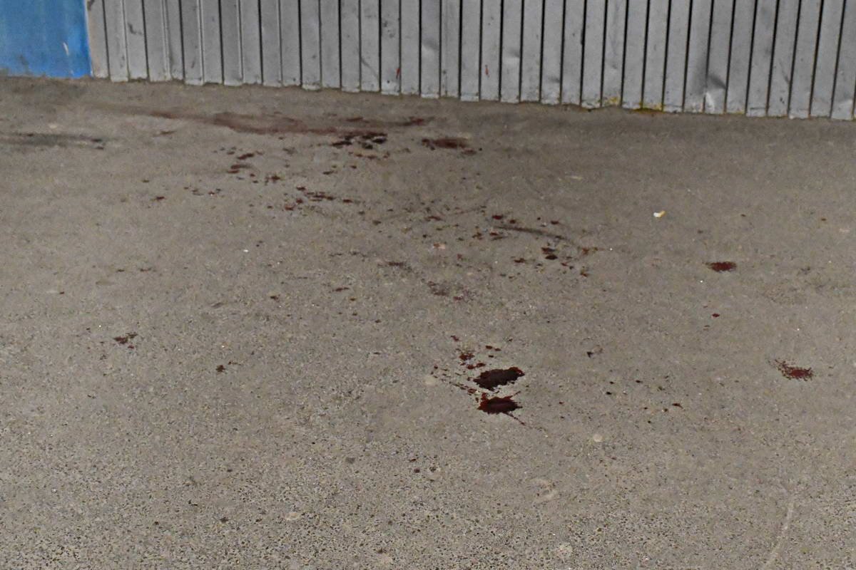 Пострадавший мужчина получил многочисленные травмы