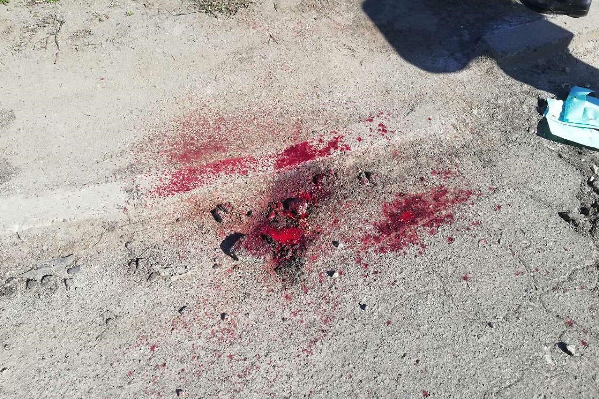 Пассажир получил обширную скальпированную рану головы и сотрясение мозга Пассажир получил обширную скальпированную рану головы и сотрясение мозга