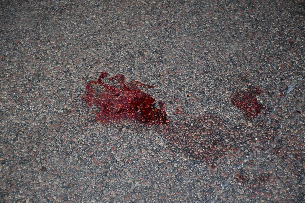 Пострадавшего госпитализировали медики с незначительными травмами