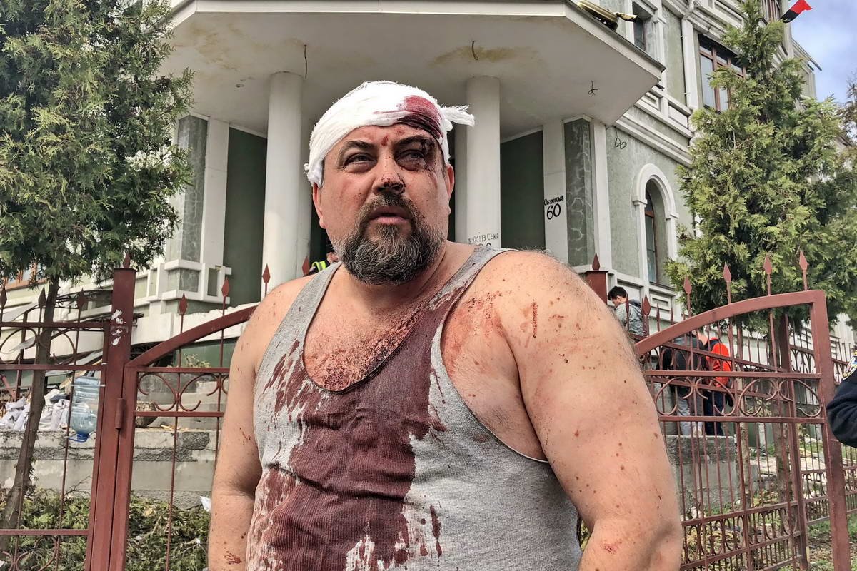 Пострадавший мужчина - переселенец из Крыма, житель общежития