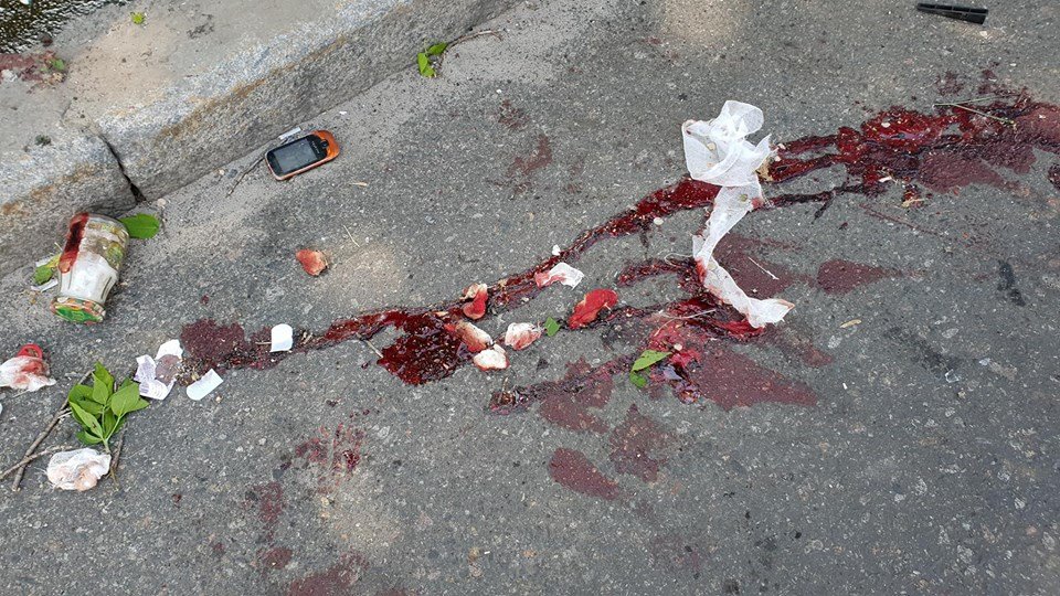 Пассажира фуры госпитализировали с травмой ноги Пассажира фуры госпитализировали с травмой ноги