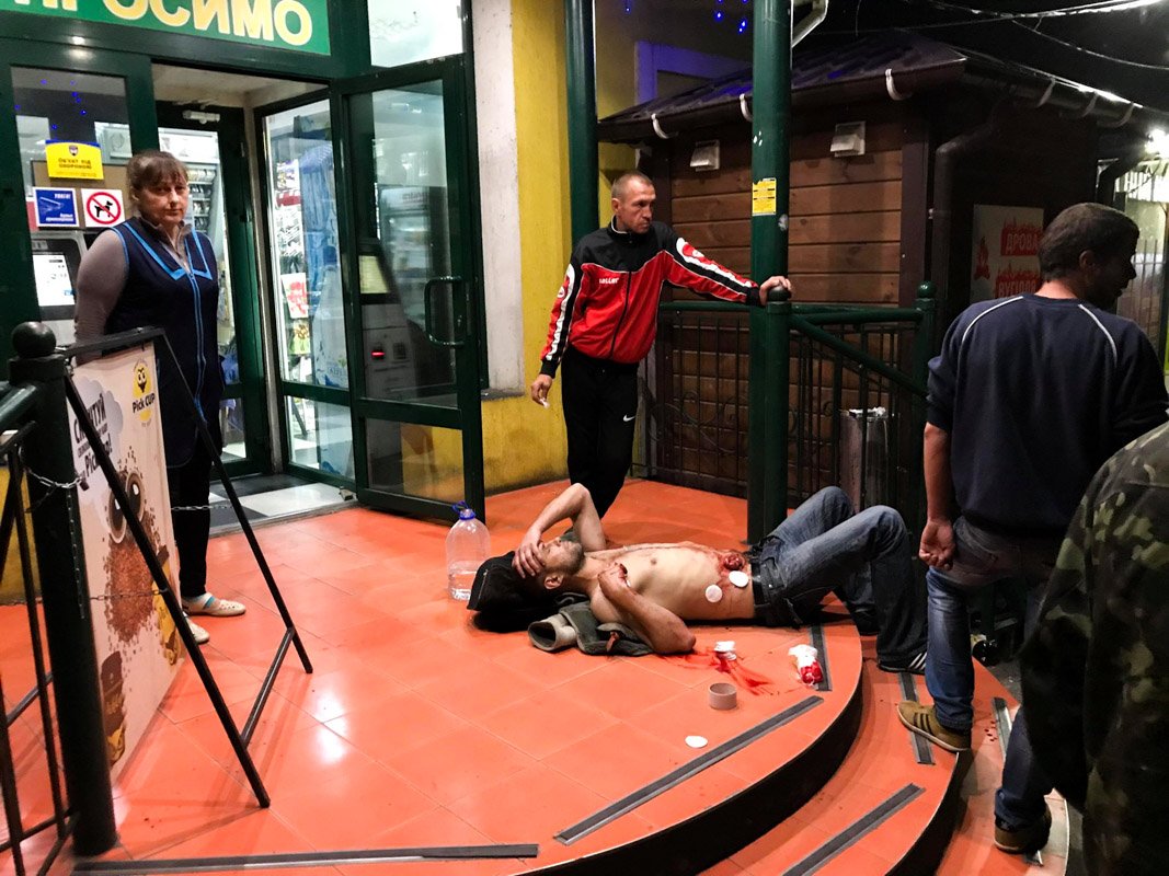 В ходе конфликта мужчина получил четыре ножевых ранения