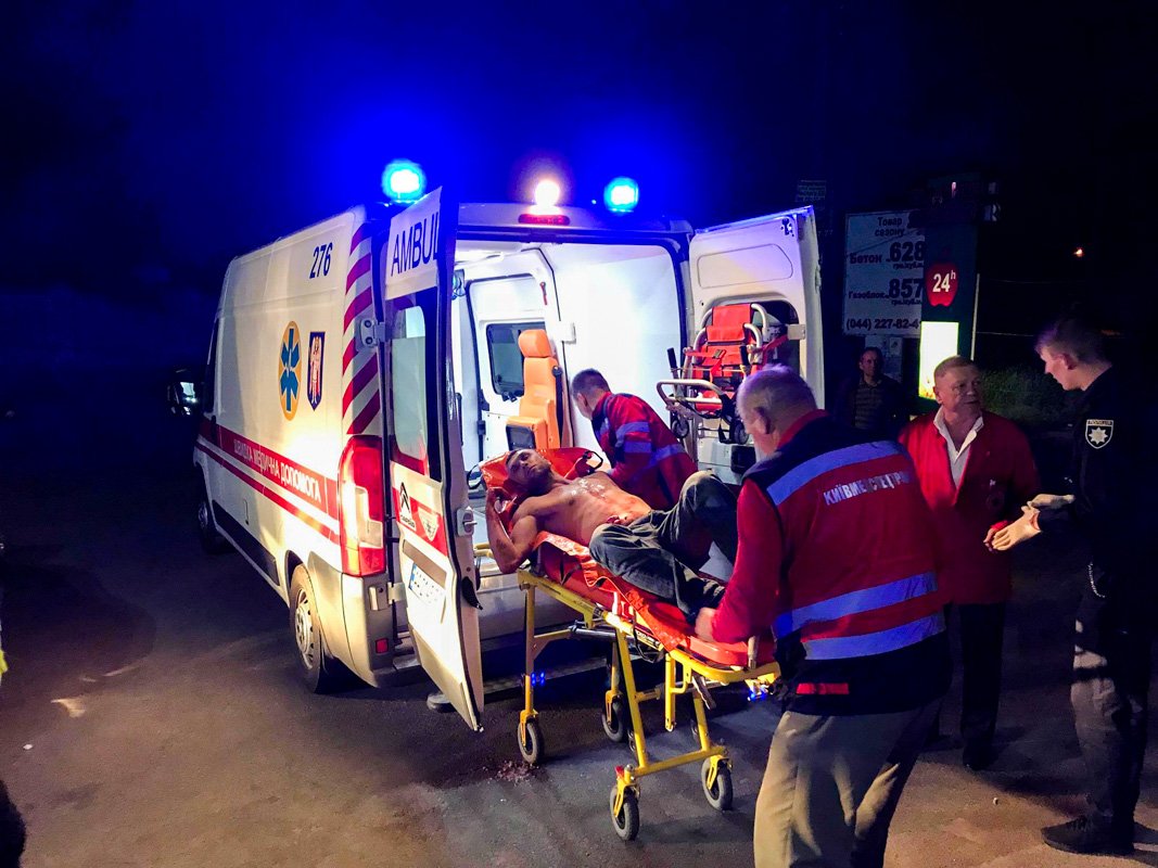 Мужчину госпитализировали в БСП