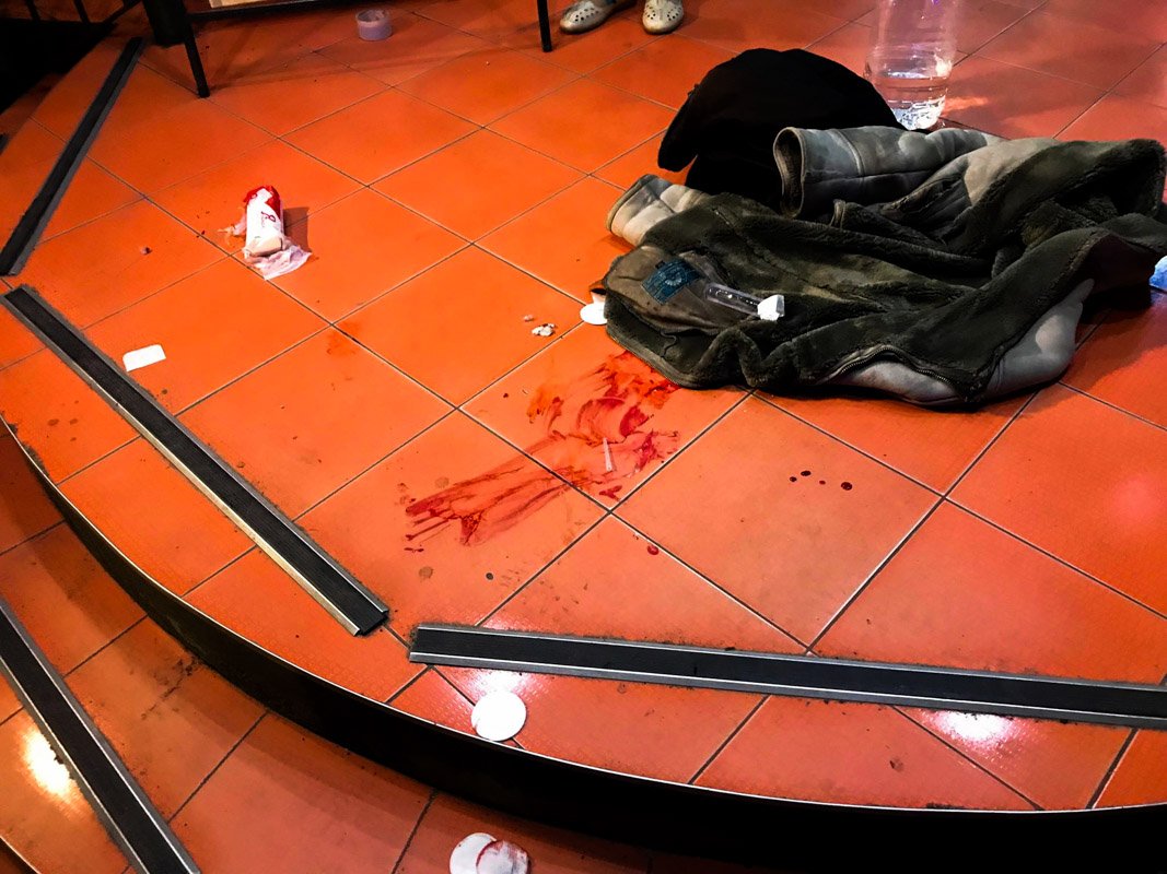 Пострадавший сам пришел на крыльцо магазина