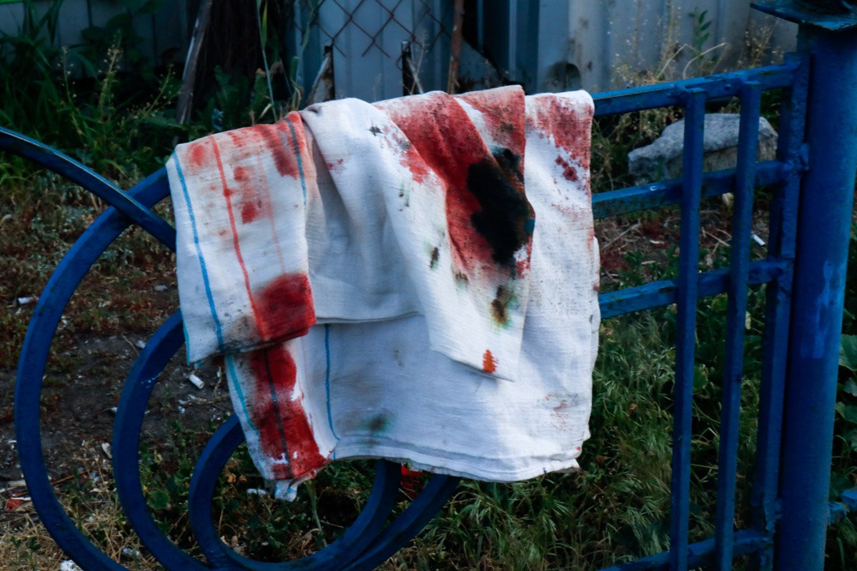 Женщина получила травму головы