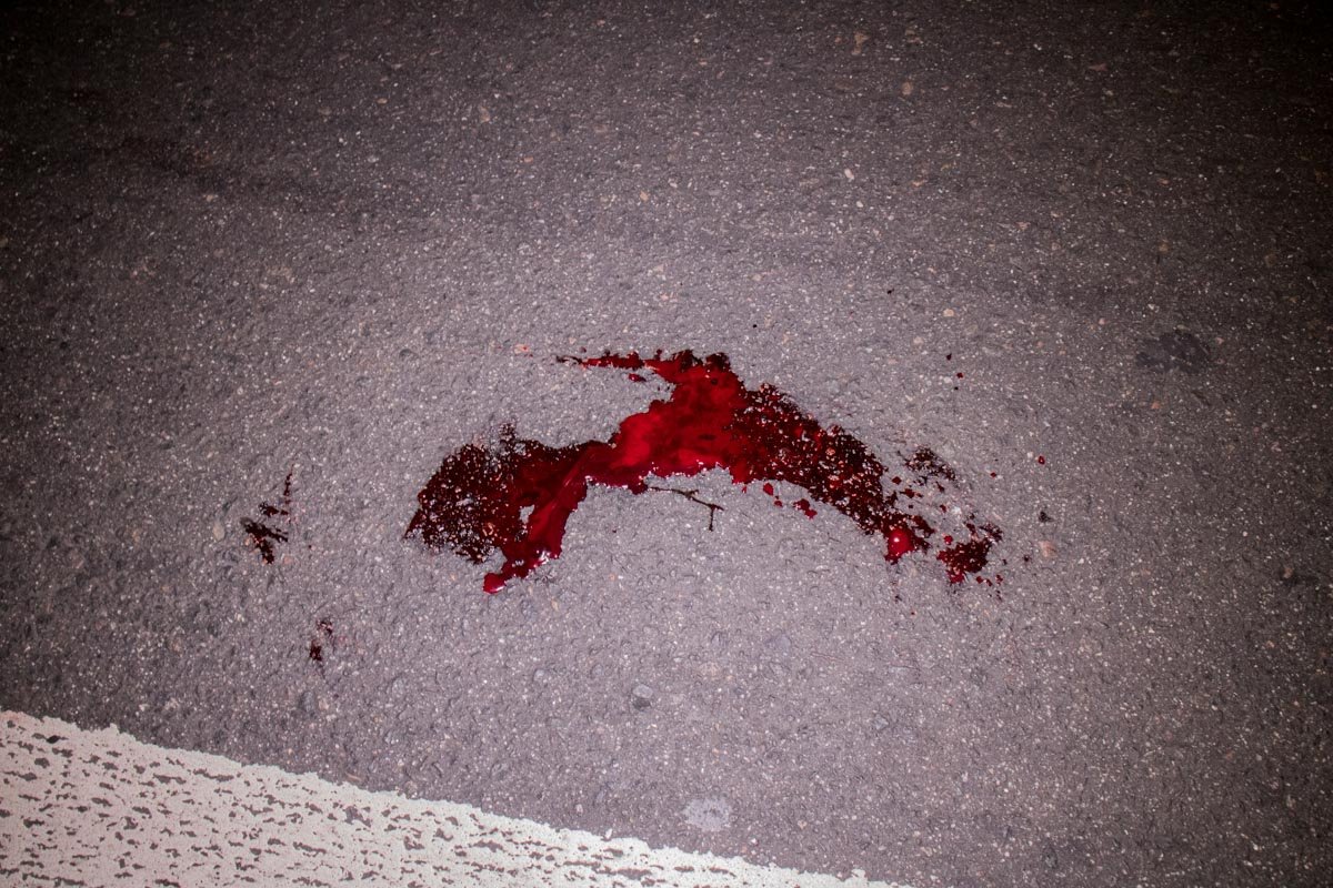 Состояние мужчины критическое