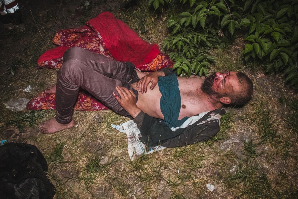 На улице Академика Евремова двое мужчин избили человека 