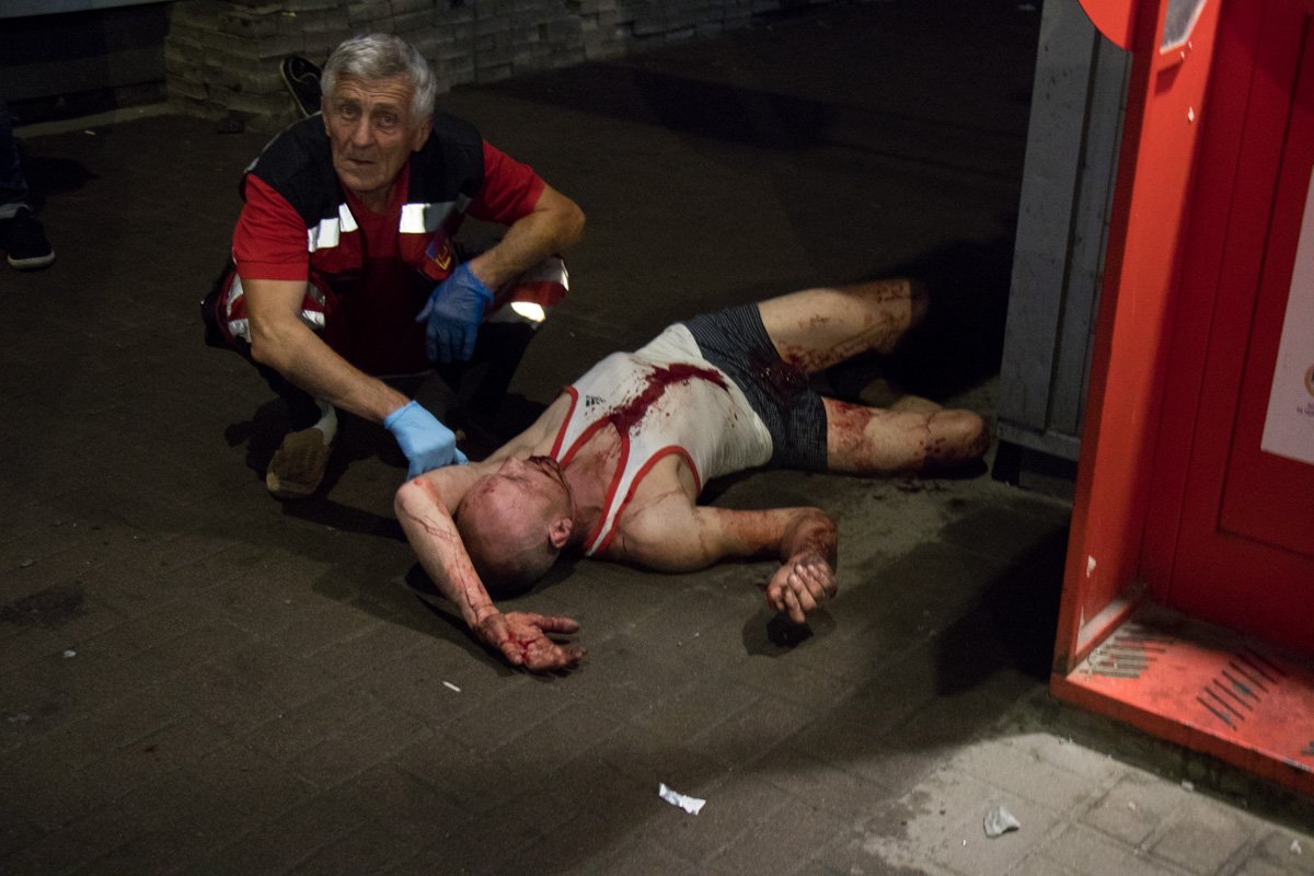 Мужчина лежал на тротуаре возле остановки общественного транспорта