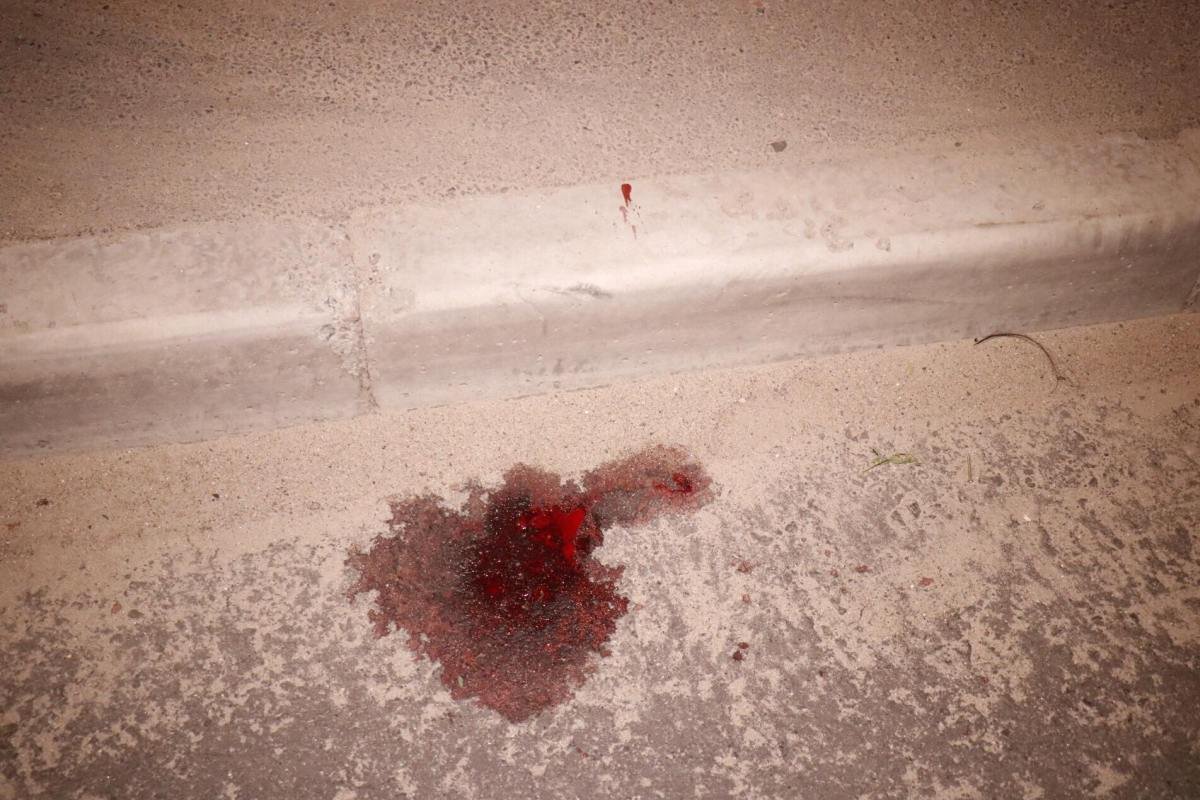 Люди увидели на проезжей части женщину с велосипедом в луже крови