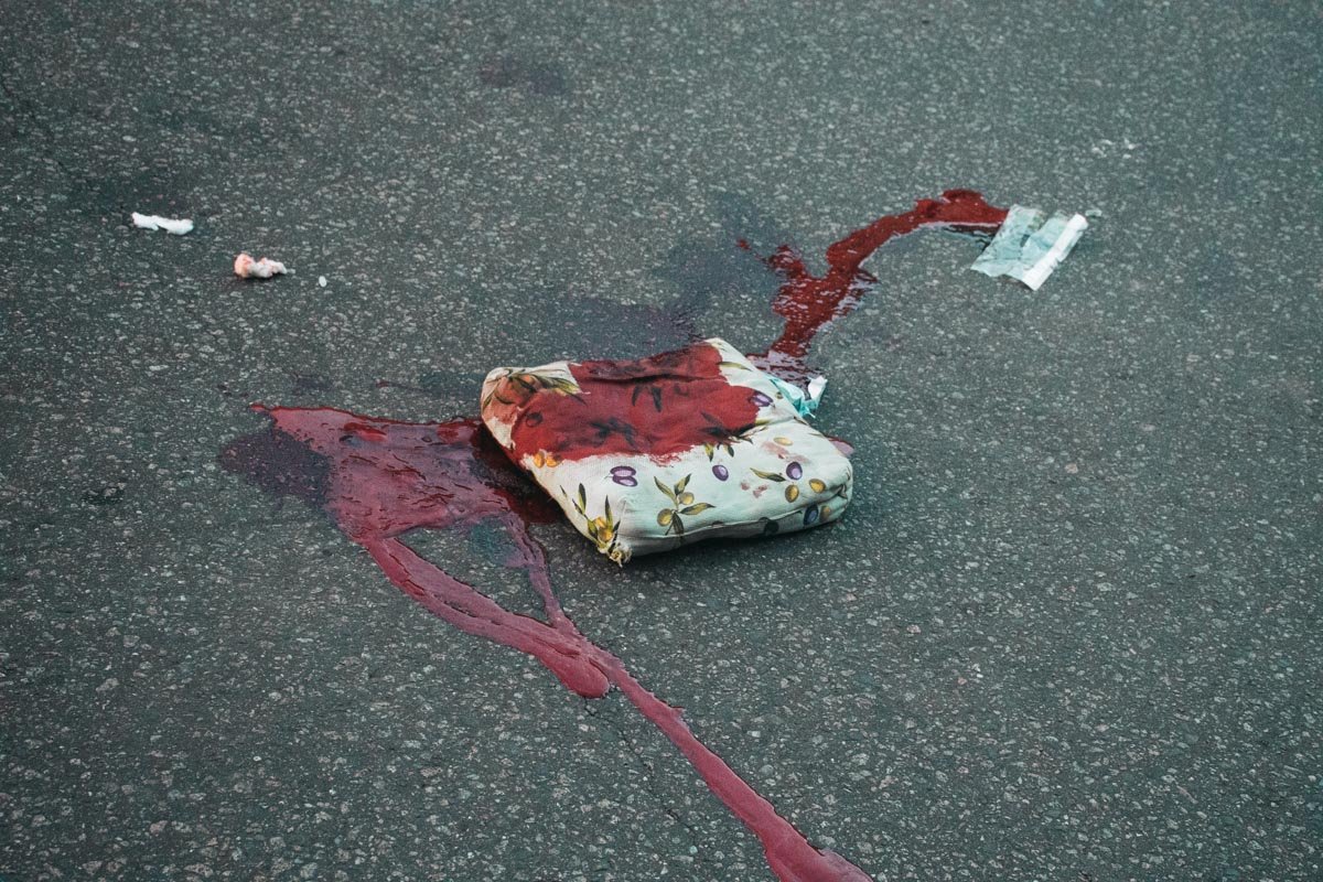 Водитель автомобиля скрылся с места происшествия. Информации по поводу марки и цвета машины пока нет