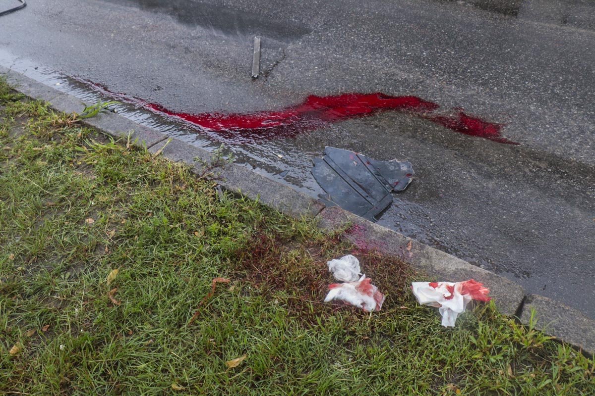 Предварительно у него открытая черепно-мозговая травма и поврежден позвоночник Предварительно у него открытая черепно-мозговая травма и поврежден позвоночник