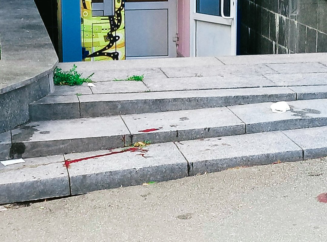 Пострадавшего сразу же госпитализировали