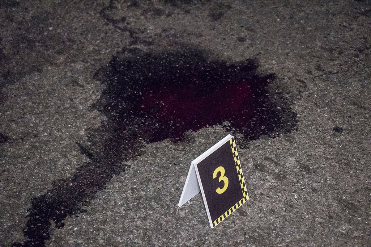 Пострадавшую госпитализировали с закрытой черепно-мозговой травмой головы, ушибом затылка и переломом левой руки Пострадавшую госпитализировали с закрытой черепно-мозговой травмой головы, ушибом затылка и переломом левой руки