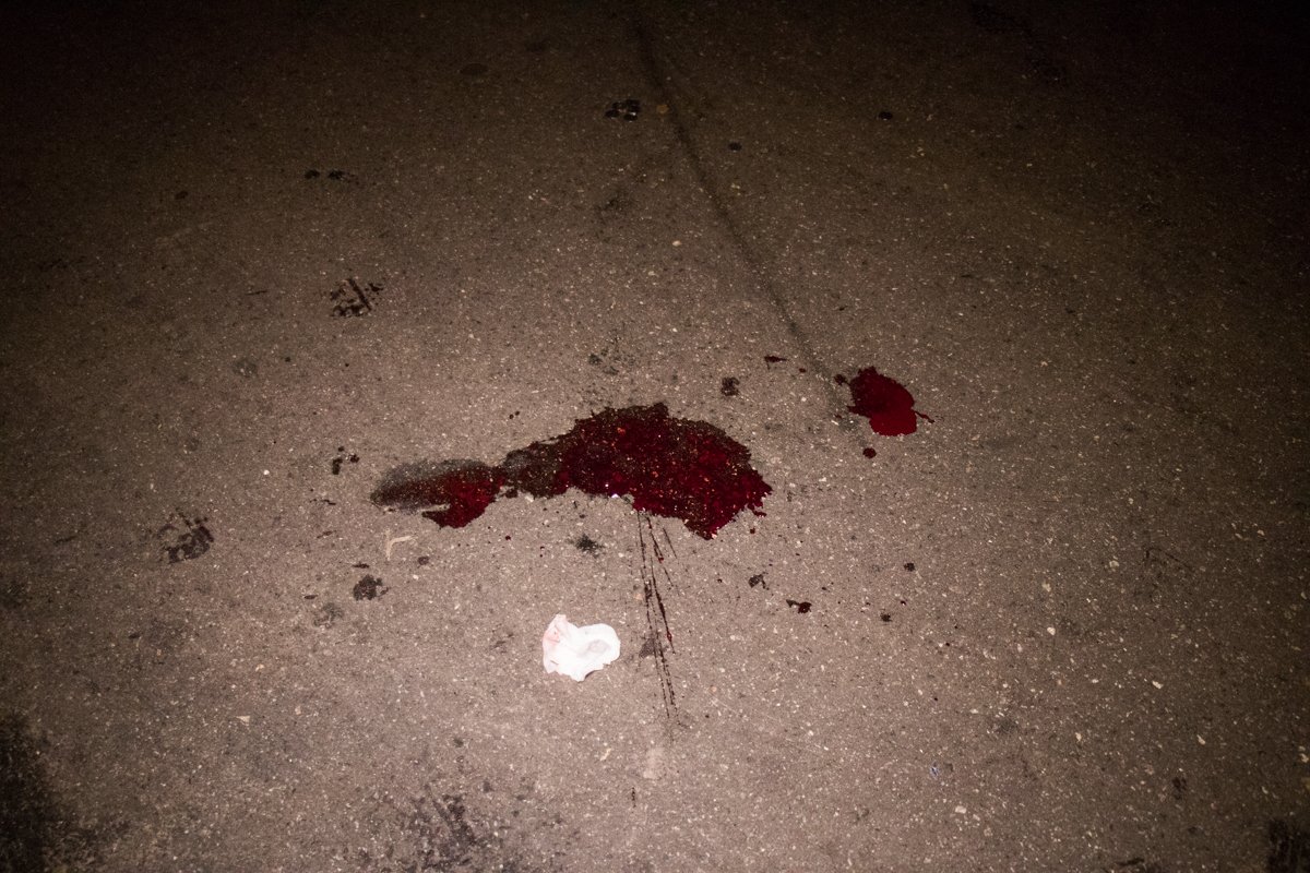 Пострадавшего госпитализировали в больницу