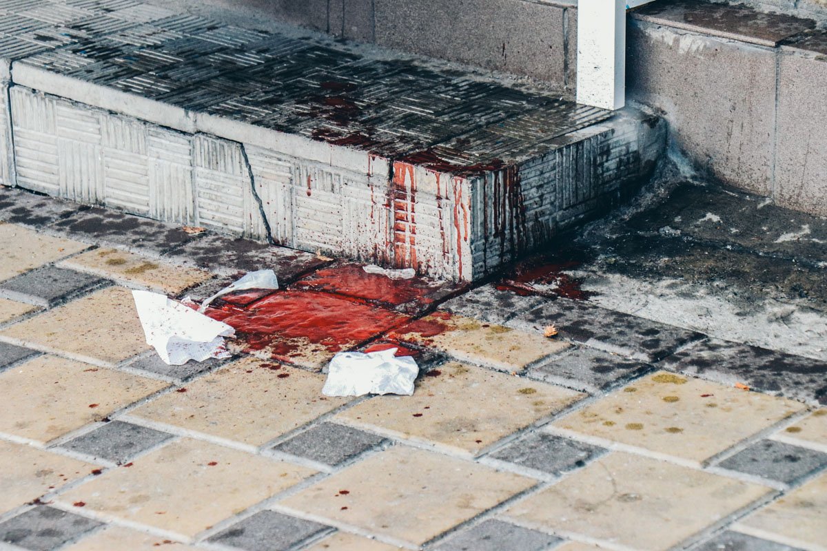 В пятницу, 20 июля, в Киеве ранили ножом молодого парня