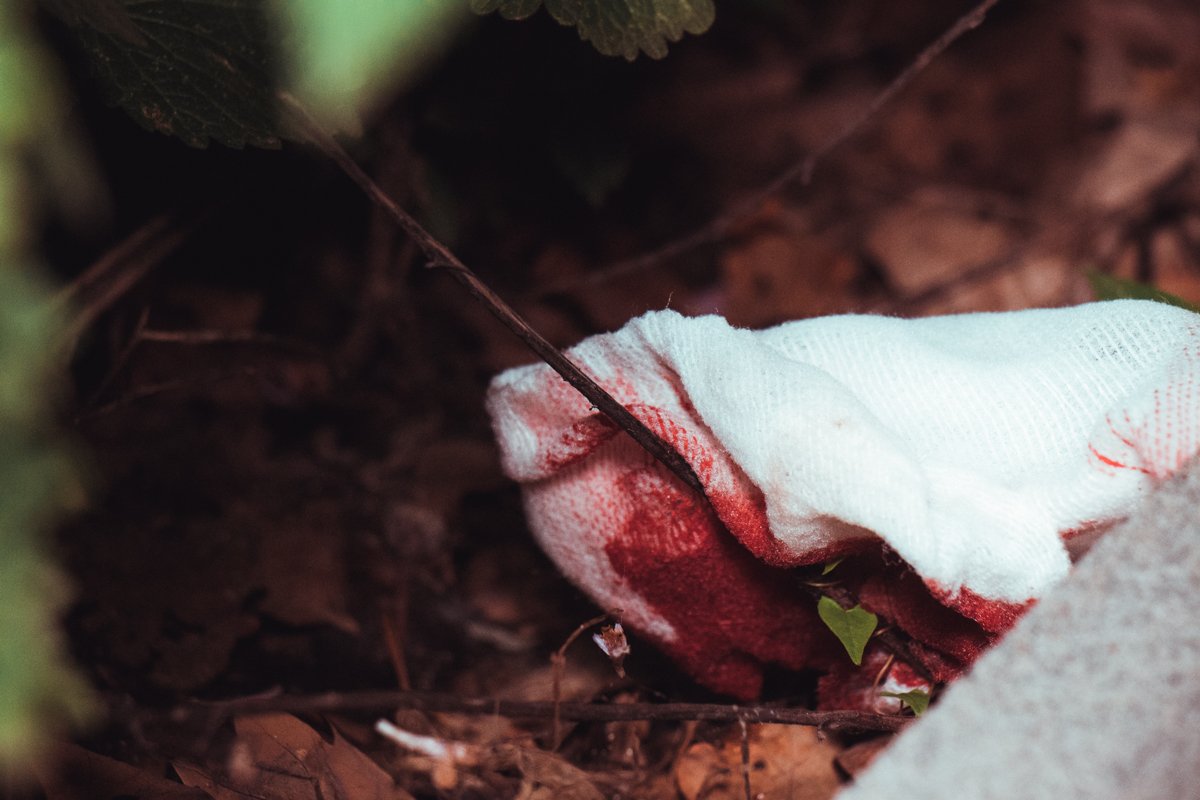 В результате наезда на женщину оба участника получили травмы В результате наезда на женщину оба участника получили травмы