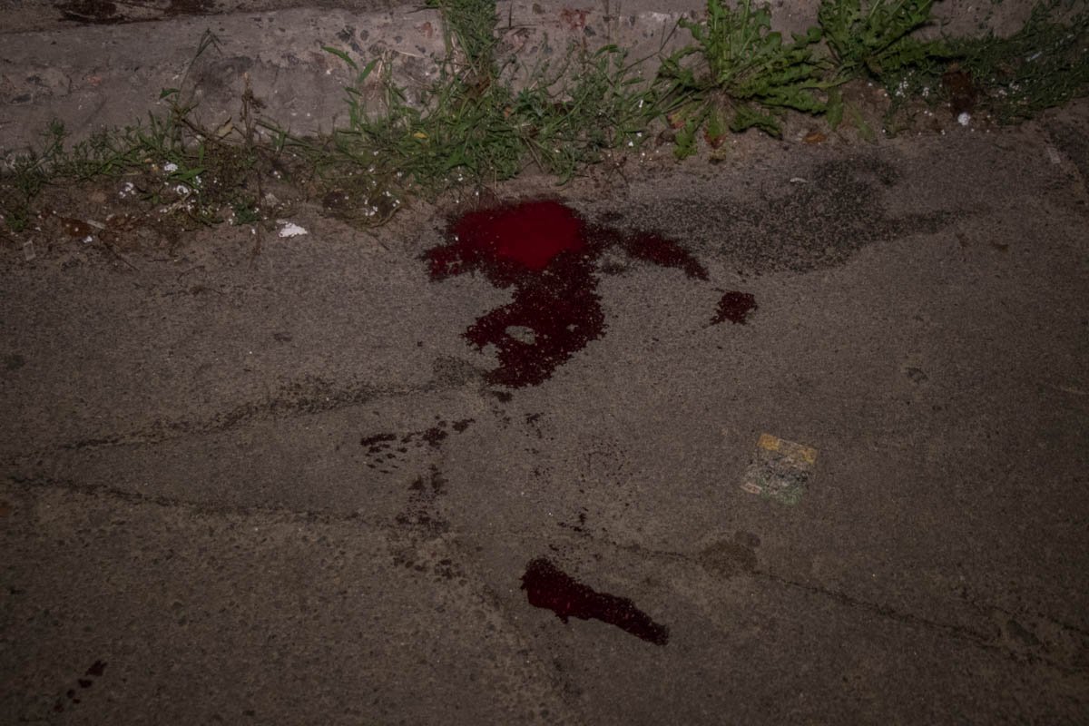 Его ограбили и порезали ножом