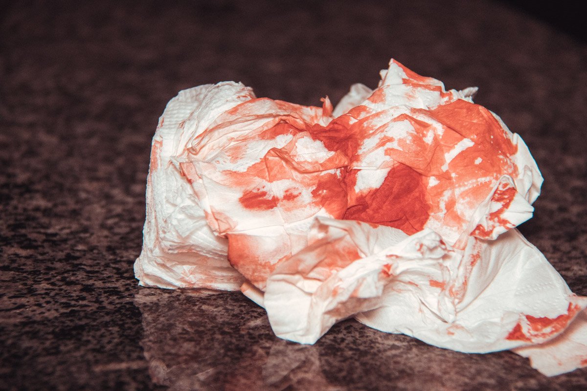 Пострадавшего мужчину госпитализировали в больницу Пострадавшего мужчину госпитализировали в больницу