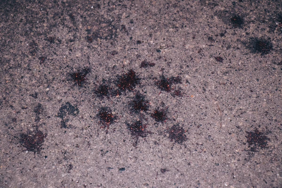 Его знакомые не растерялись и перемотали место пореза скотчем