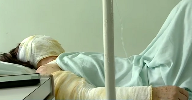 В Херсоне облили кислотой чиновницу горсовета