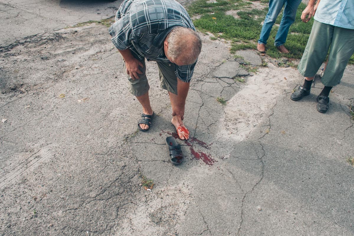 Пострадавшему мужчине прострелили ногу Пострадавшему мужчине прострелили ногу