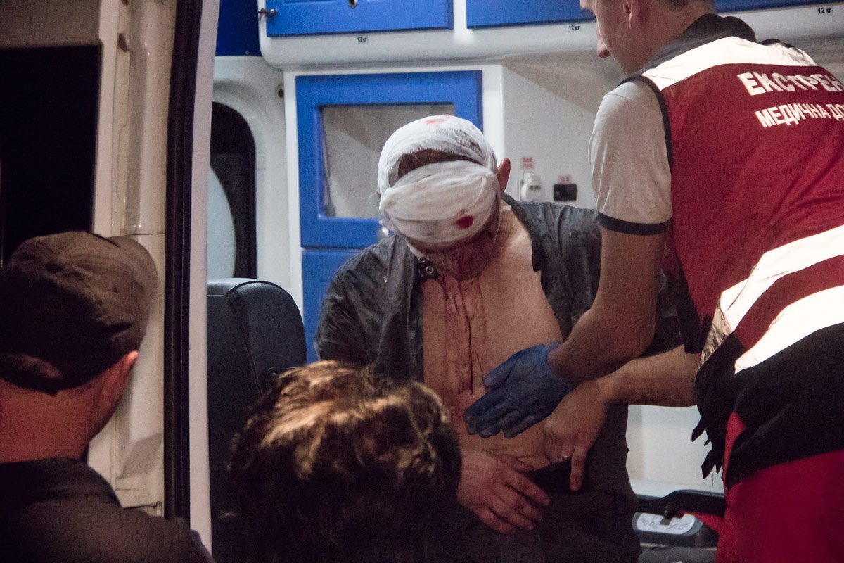 На Караваевых дачах произошла драка между двумя пьяными мужчинами