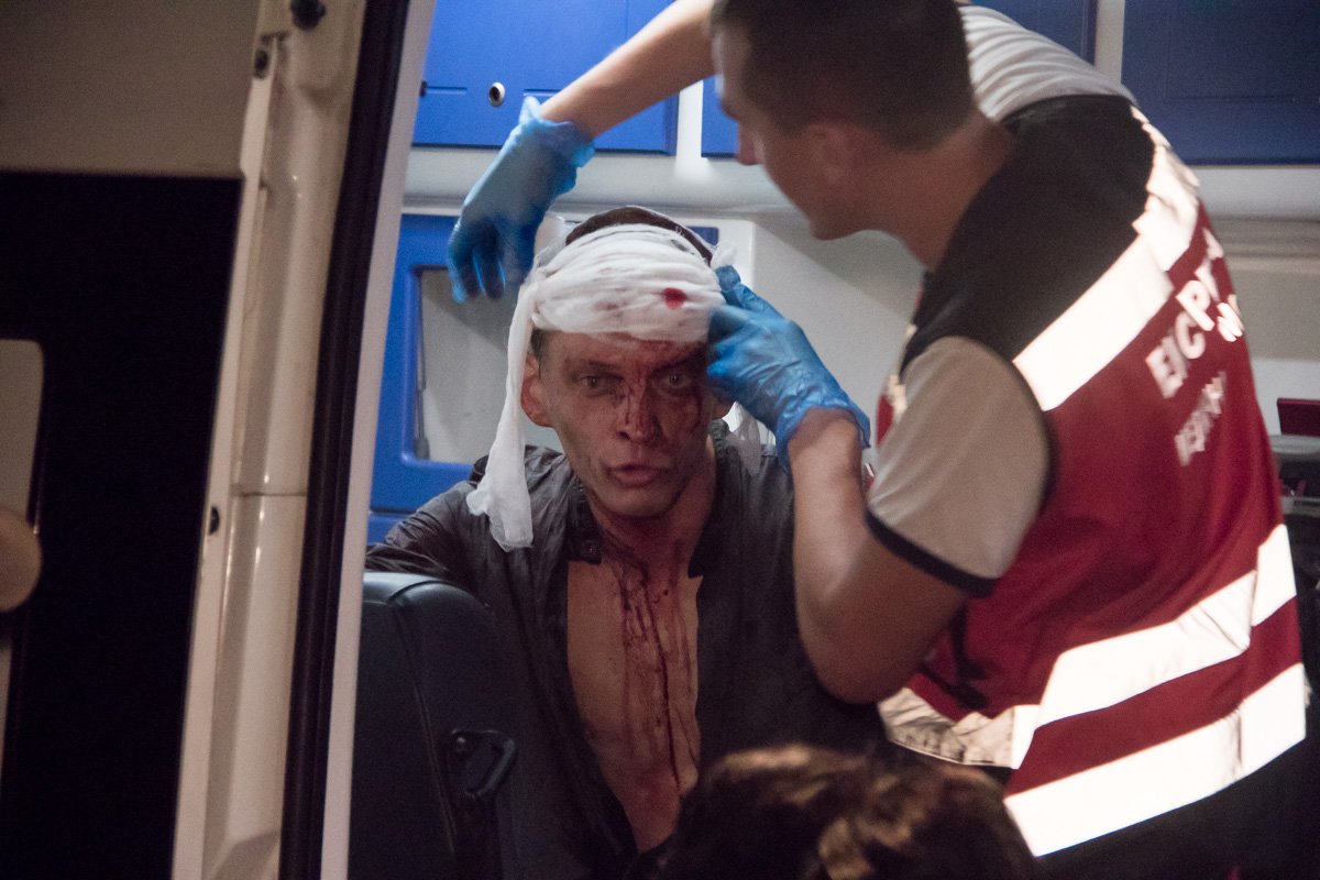 Конфликт произошел на почве ревности