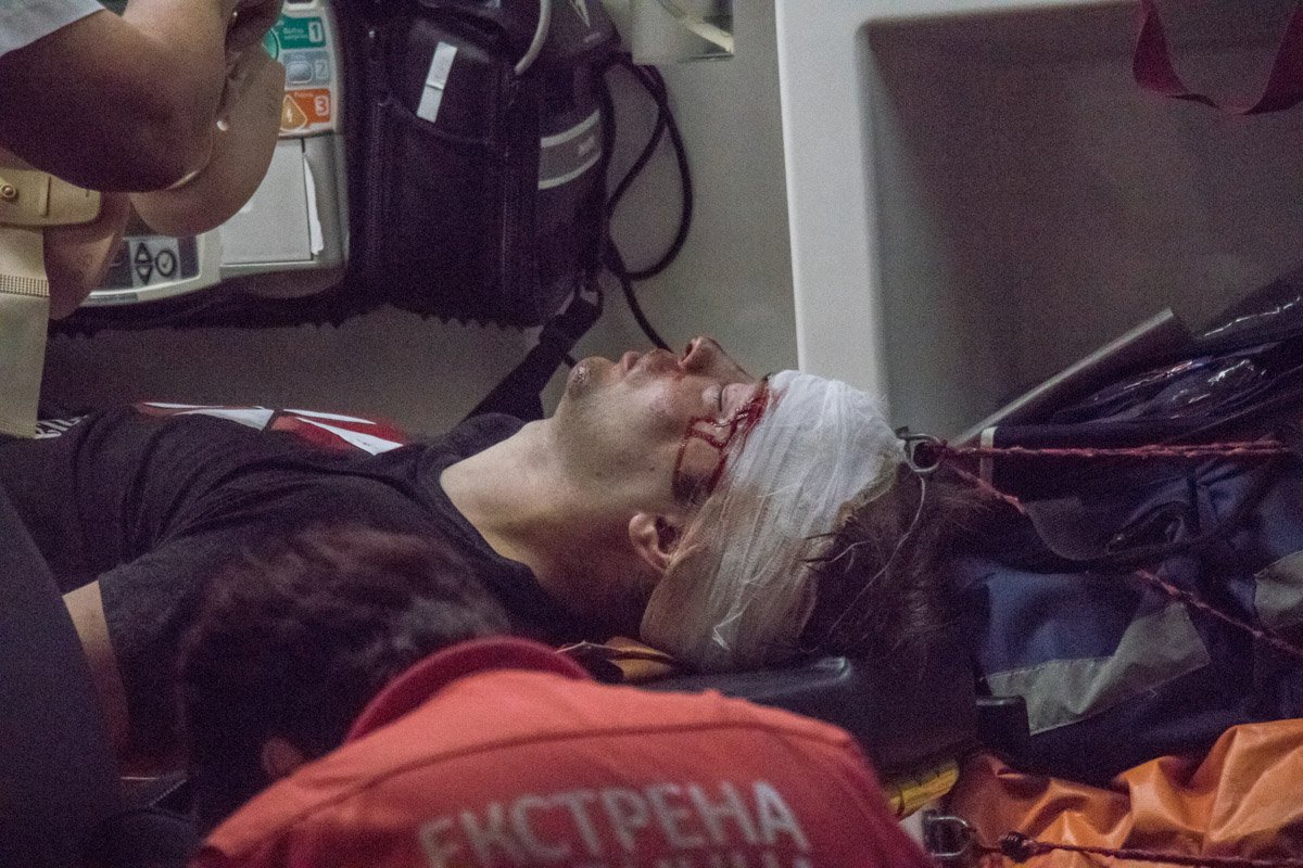 С открытой черепно-мозговой травой и ушибами всего тела его госпитализировали